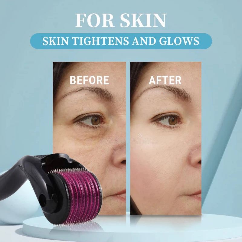 Micro Needling 540 Roller