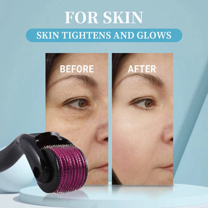 Micro Needling 540 Roller