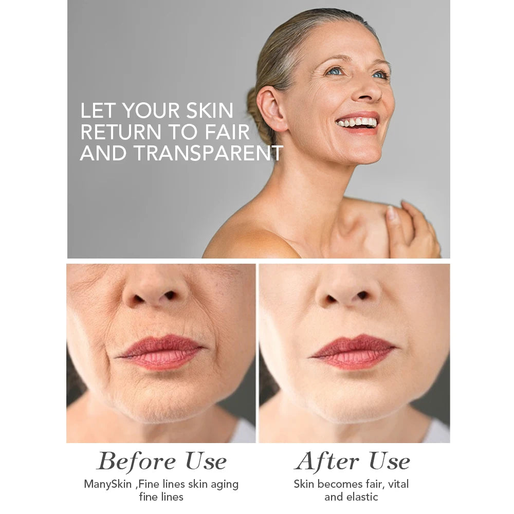 AILKE Face Cream With Hyaluron Scars