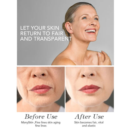 AILKE Face Cream With Hyaluron Scars