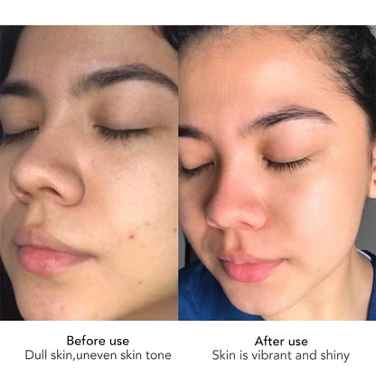 AILKE Face Cream With Hyaluron Scars