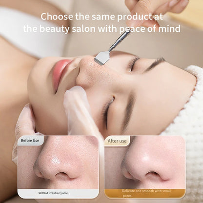Stainless Steel Blackhead Scraper