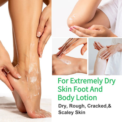 42% Urea & 2% Salicylic Acid Foot Cream