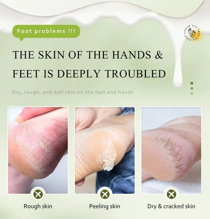 Urea Coconut Oil Foot Cream